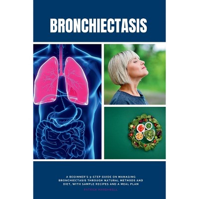 Bronchiectasis - by  Patrick Marshwell (Paperback)