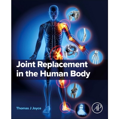 Joint Replacement in the Human Body - by  Thomas J Joyce (Paperback)
