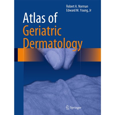 Atlas of Geriatric Dermatology - by  Robert A Norman & Edward M Young Jr (Hardcover)
