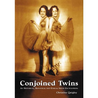 Conjoined Twins - by  Christine Quigley (Paperback)