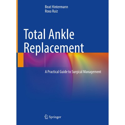 Total Ankle Replacement - by  Beat Hintermann & Roxa Ruiz (Hardcover)