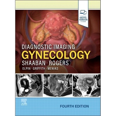 Diagnostic Imaging: Gynecology - 4th Edition by  Akram M Shaaban & Douglas Rogers (Hardcover)