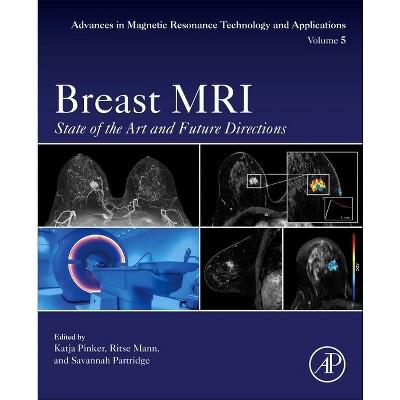 Breast MRI - (Advances in Magnetic Resonance Technology and Applications) by  Katja Pinker & Ritse Mann & Savannah Partridge (Paperback)