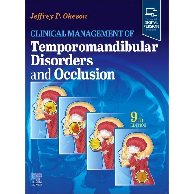 Clinical Management of Temporomandibular Disorders and Occlusion - 9th Edition by  Jeffrey P Okeson (Hardcover)