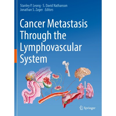 Cancer Metastasis Through the Lymphovascular System - by  Stanley P Leong & S David Nathanson & Jonathan S Zager (Paperback)