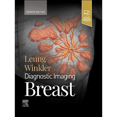 Diagnostic Imaging: Breast - 4th Edition by  Jessica W T Leung & Nicole S Winkler (Hardcover)